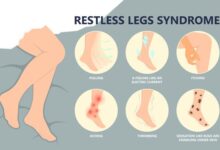 Photo of पैरों में दर्द है ? जाने Rest Leg Syndrome के लक्षण के बारे में और उसके उपाय….
